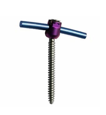 Stable screw-rod construct Stable screw-rod construct
