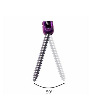 50 degree angulation 50 degree angulation
