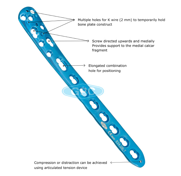 fix<em>LOCK</em> Medial Distal  Tibia Plate, without Tab 