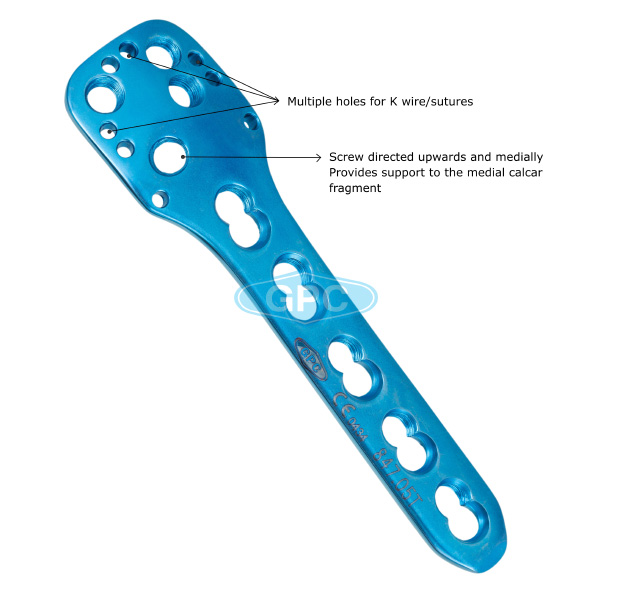 fix<em>LOCK</em> Proximal Humerus Plate, 3.5 mm 