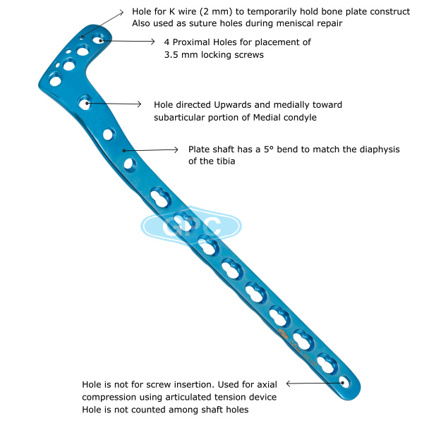 fix<em>LOCK</em> Proximal Tibia  Plate, 3.5 mm