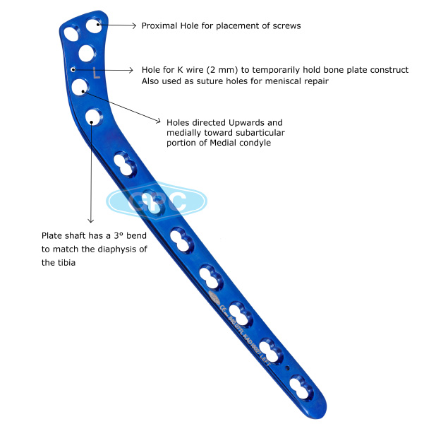 fix<em>LOCK</em> Proximal Tibia Plate