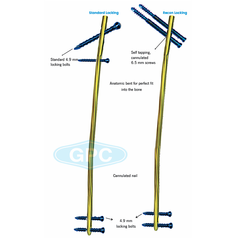 intra<em>HEAL</em> Multi Angle Femoral Nail